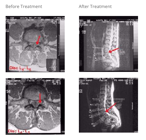 Vertetrac Casestudy